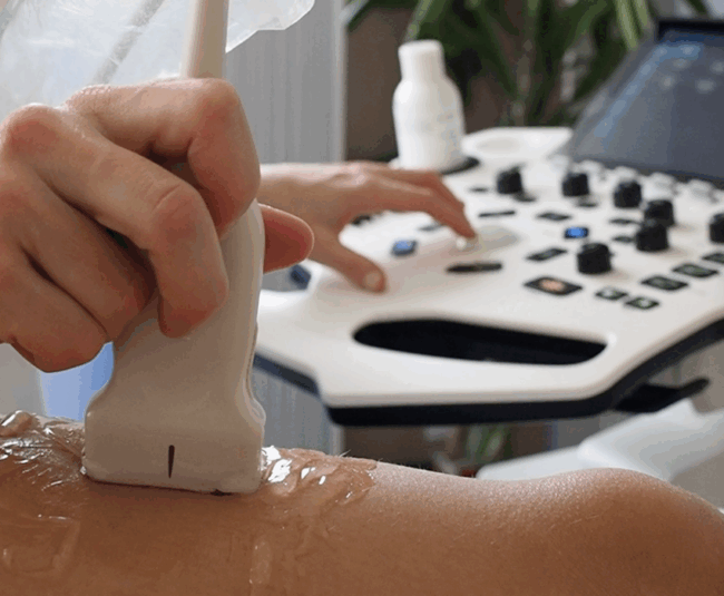 Ecografia Musculoesquelètica