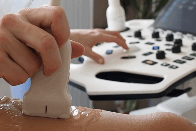 Ecografia Musculoesquelètica