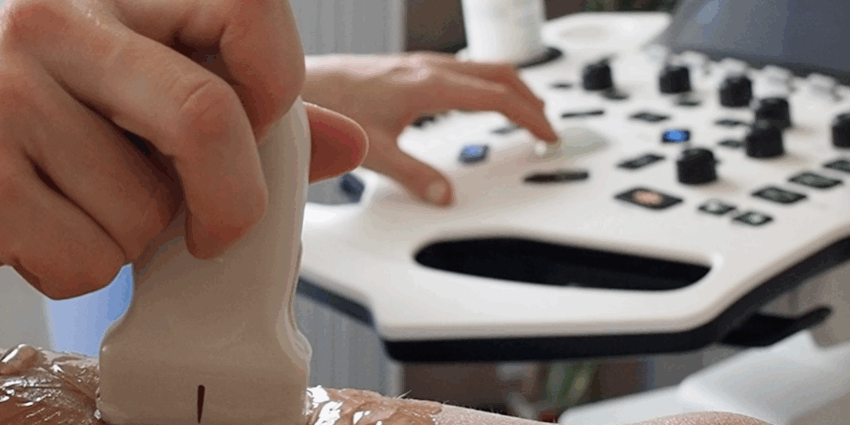 Ecografia Musculoesquelètica