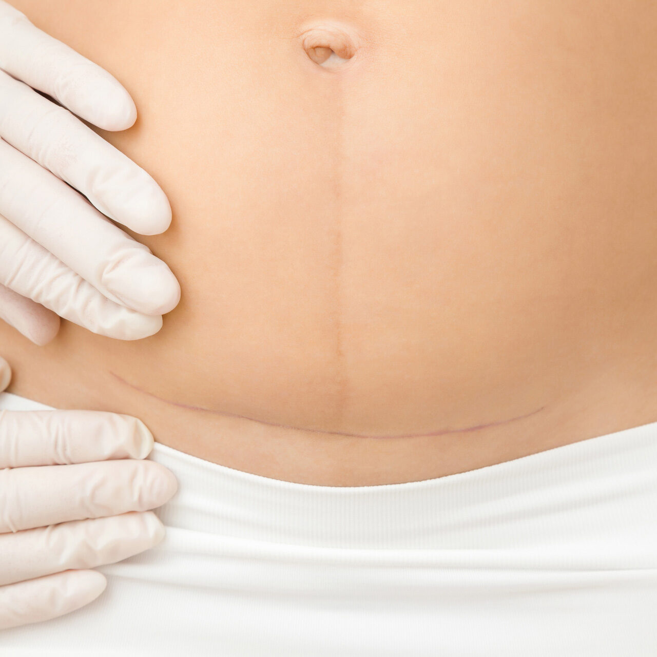 Fisioterapia Pre i Postquirurgic