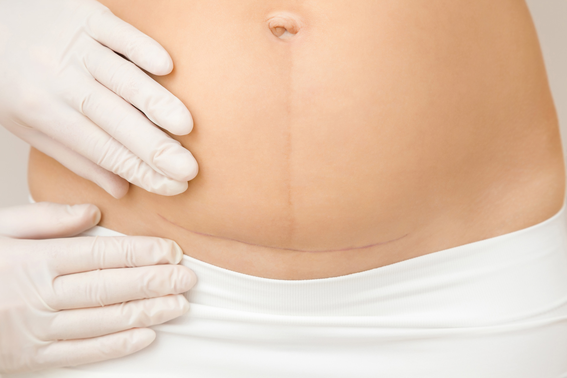 Fisioterapia Pre i Postquirurgic
